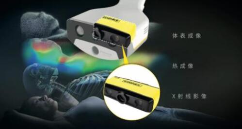 康耐视3D-A5060三维面阵视觉系统助力精准放疗,实现人体定位监控新维度(图1) 康耐视3D-A5060三维面阵视觉系统助力精准放疗,实现人体定位监控新维度(图1)